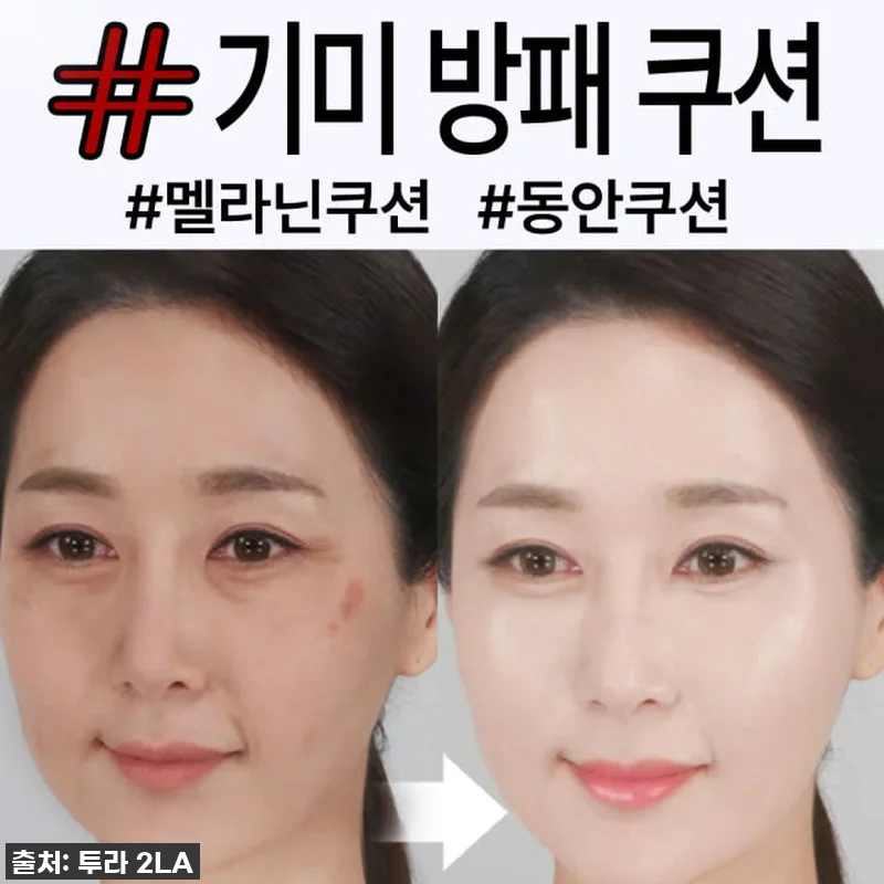 피부 고민 한 방에 싹! [면세점 입 관련 이미지 1