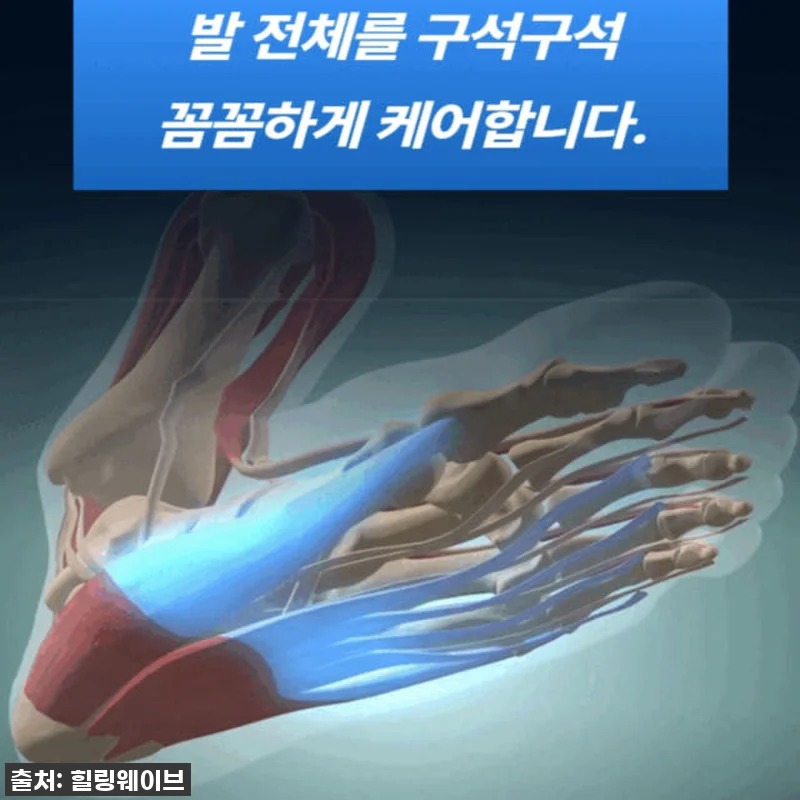지긋지긋한 발 통증, 드디어 탈출! 관련 이미지 4