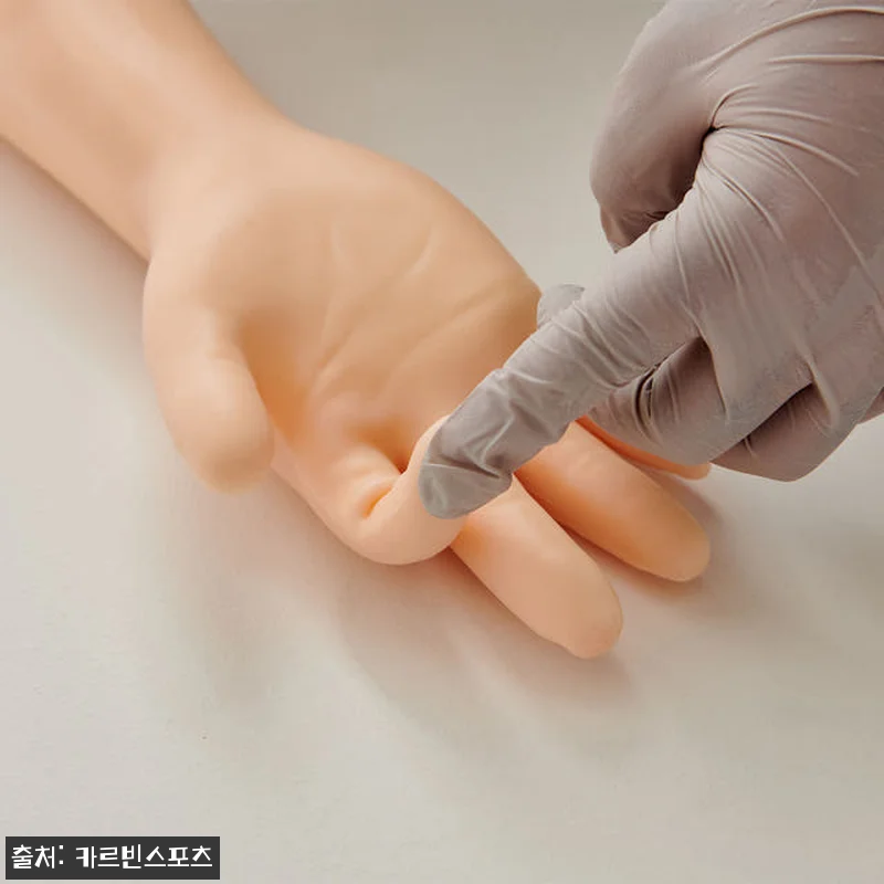 정맥 주사 연습 IV 간호 모형 사용 후기: 실제 연습에 딱 맞는 실습 도구 19 정맥 주사 연습 IV 간호 모형 사용 관련 이미지 8